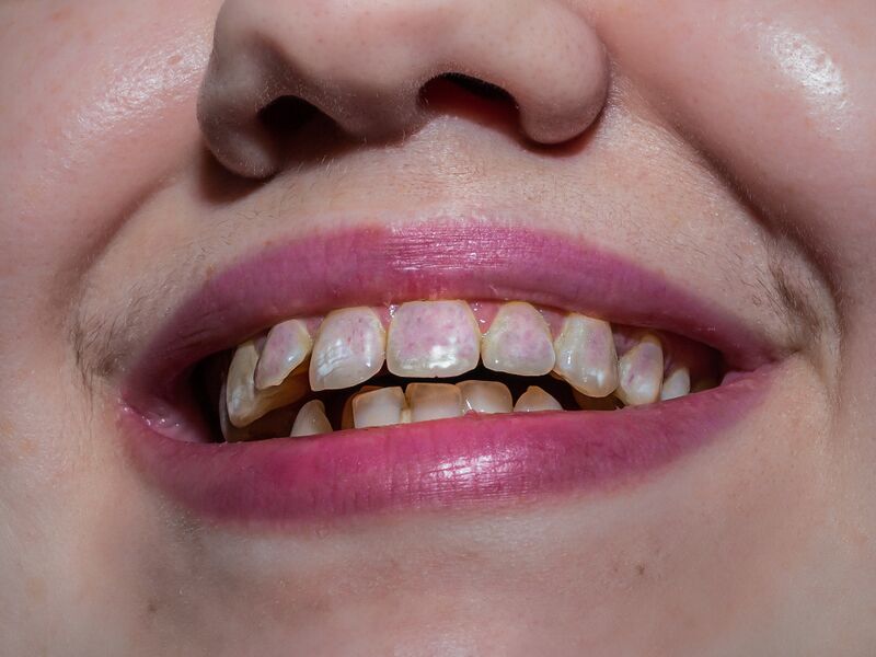 File:Nika Sandler A History of Teeth .jpg